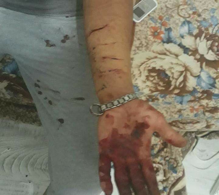 پناهجوی دگرباش در غرب ترکیه مورد حمله قرار گرفت